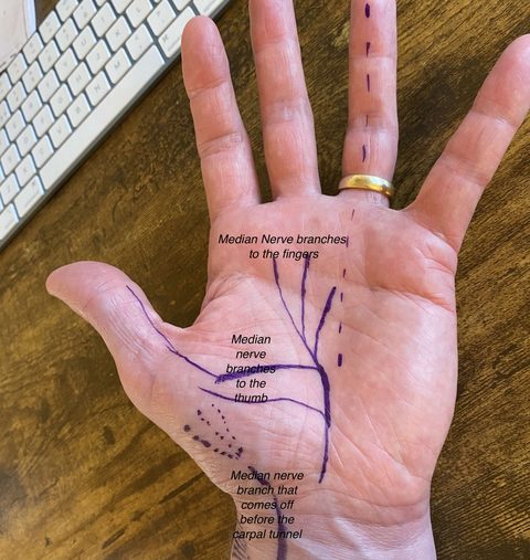 Anatomical drawing of the median nerve running through the wrist into the hand